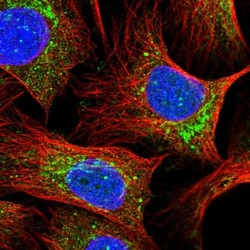 MNF1 Antibody, Novus Biologicals:Antibodies:Primary Antibodies